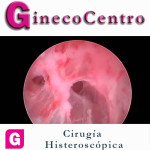 GC CIRUGIA HISTEROSCOPICA.