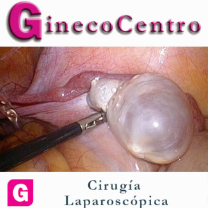 GC CIRUGIA LAPAROCOPICA